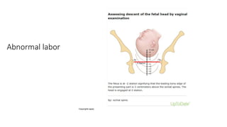 Abnormal labor neonatal pg (1).pptx