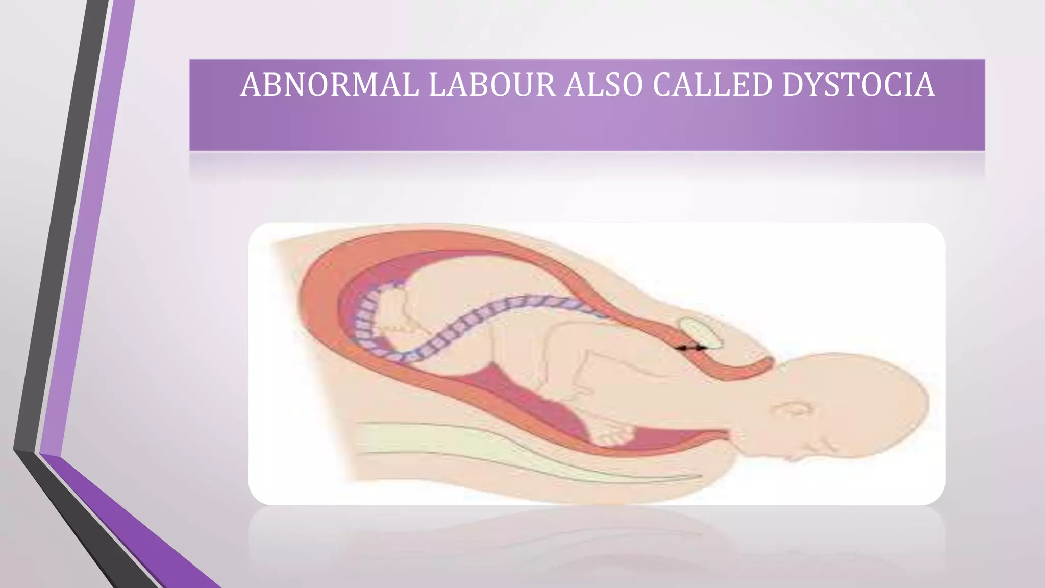 ABNORMAL LABOUR | PPTX