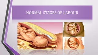 ABNORMAL LABOUR | PPTX