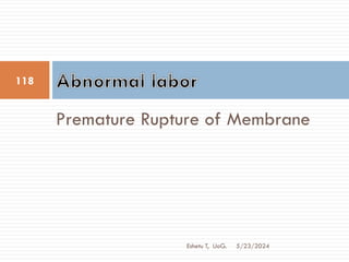 Premature Rupture of Membrane
5/23/2024
118
Eshetu T, UoG.
 