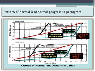 Rinner Abnormal Dystocia and Abnormal progress of labour.pptx