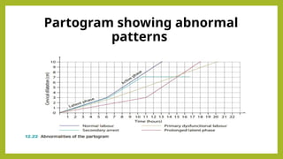 Comprehensive Overview of Abnormal Labour: Causes, Diagnosis, and ...