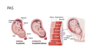 Abnormal Labour- Part 2.pptx Fmedicine students | PPTX