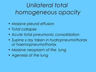 Unilateral total
homogeneous opacity
• Massive pleural effusion
• Total collapse
• Acute total pneumonic consolidation
• Supine x ray taken in hydropneumothorax
or haemopneumothorax
• Massive neoplasm of the lung
• Agenesis of the lung
 