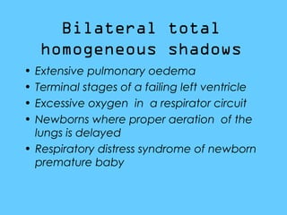 Bilateral total
homogeneous shadows
• Extensive pulmonary oedema
• Terminal stages of a failing left ventricle
• Excessive oxygen in a respirator circuit
• Newborns where proper aeration of the
lungs is delayed
• Respiratory distress syndrome of newborn
premature baby
 