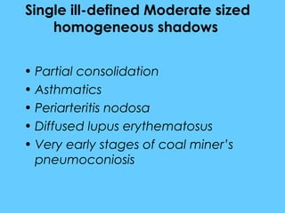 Single ill-defined Moderate sized
homogeneous shadows
• Partial consolidation
• Asthmatics
• Periarteritis nodosa
• Diffused lupus erythematosus
• Very early stages of coal miner’s
pneumoconiosis
 
