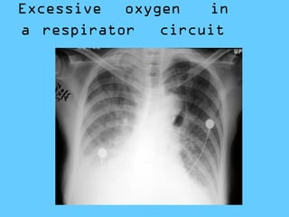 abnormal lung xray for education ppp.pptx