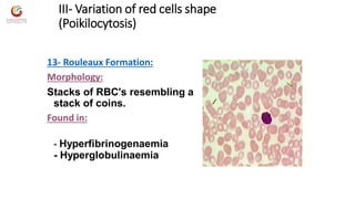 Variation In Rbc Shape Abnormal morphology of rbc notes | PDF