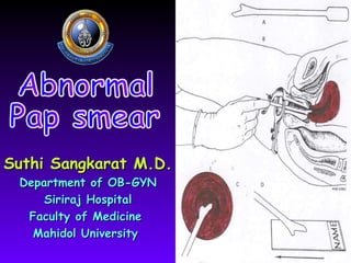 Suthi Sangkarat M.D.  Department of OB-GYN Siriraj Hospital Faculty of Medicine  Mahidol University  Abnormal  Pap smear 