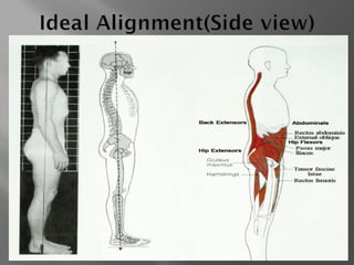 Abnormal posture in human body biomechanics.pdf