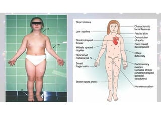 PUBERTY AND ABNORMALITIES ITS TREATMENT | PPTX
