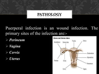 Puerperal infection is an wound infection. The
primary sites of the infection are:-
 Perineum
 Vagina
 Cervix
 Uterus
 