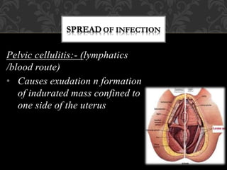 Pelvic cellulitis:- (lymphatics
/blood route)
• Causes exudation n formation
of indurated mass confined to
one side of the uterus
 