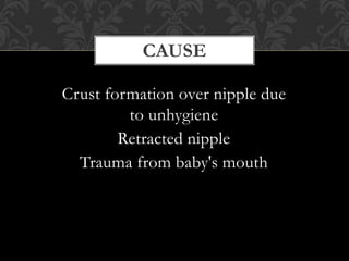 CAUSE
Crust formation over nipple due
to unhygiene
Retracted nipple
Trauma from baby's mouth
 