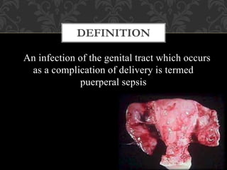 An infection of the genital tract which occurs
as a complication of delivery is termed
puerperal sepsis
DEFINITION
 