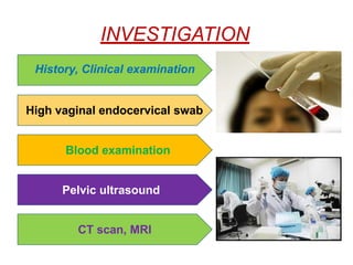 INVESTIGATION
History, Clinical examination
High vaginal endocervical swab
Blood examination
Pelvic ultrasound
CT scan, MRI
 