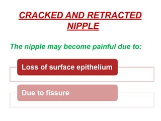 CRACKED AND RETRACTED
NIPPLE
The nipple may become painful due to:
 