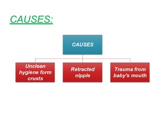 CAUSES:
 