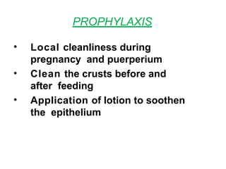 PROPHYLAXIS
• Local cleanliness during
pregnancy and puerperium
• Clean the crusts before and
after feeding
• Application of lotion to soothen
the epithelium
 