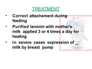 TREATMENT
• Correct attachement during
feeding
• Purified lanonin with mother's
milk applied 3 or 4 times a day for
healing
• In severe cases expression of
milk by breast pump
 