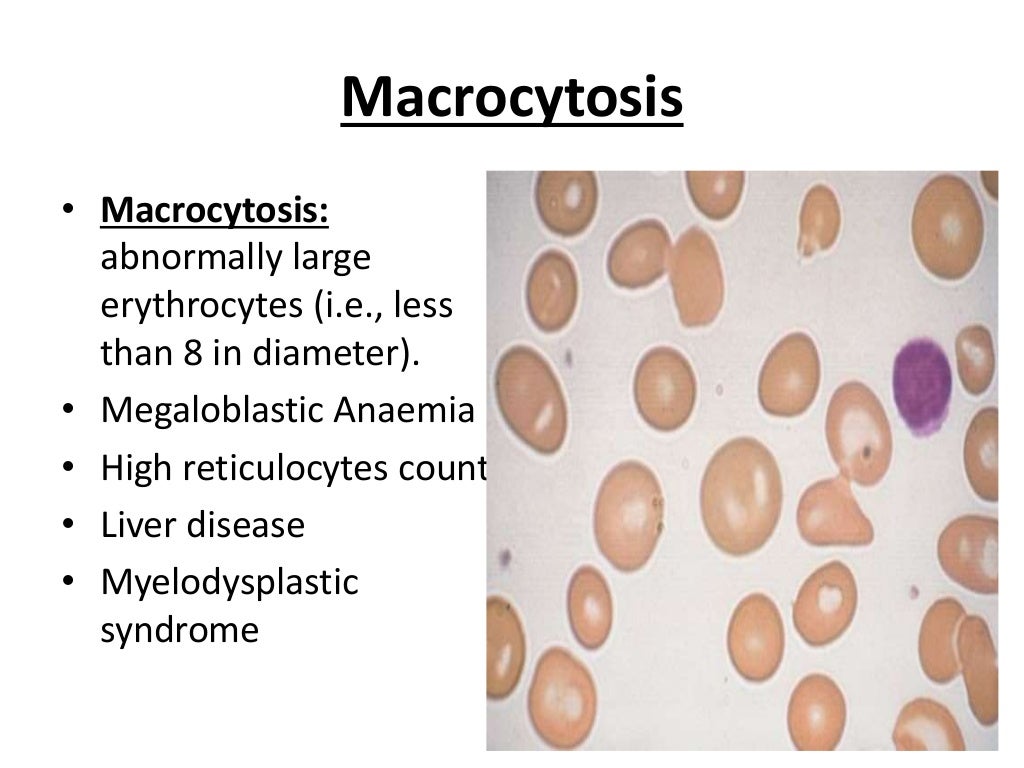 Abnormal red blood cell morphologies