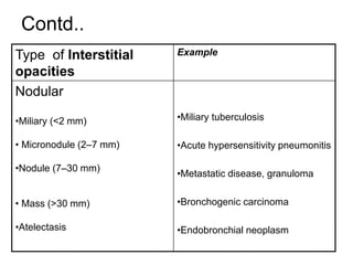 Contd..
Type of Interstitial
opacities
Example
Nodular
•Miliary (<2 mm)
• Micronodule (2–7 mm)
•Nodule (7–30 mm)
• Mass (>30 mm)
•Atelectasis
•Miliary tuberculosis
•Acute hypersensitivity pneumonitis
•Metastatic disease, granuloma
•Bronchogenic carcinoma
•Endobronchial neoplasm
 
