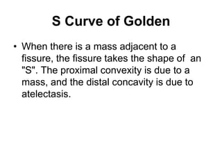 S Curve of Golden
• When there is a mass adjacent to a
fissure, the fissure takes the shape of an
"S". The proximal convexity is due to a
mass, and the distal concavity is due to
atelectasis.
 