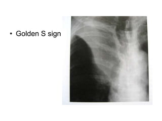 • Golden S sign
 