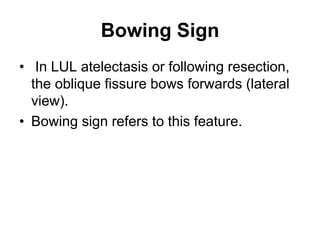 Bowing Sign
• In LUL atelectasis or following resection,
the oblique fissure bows forwards (lateral
view).
• Bowing sign refers to this feature.
 
