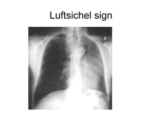Luftsichel sign
 
