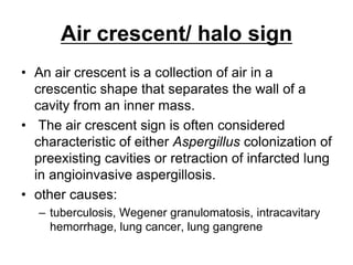 Air crescent/ halo sign
• An air crescent is a collection of air in a
crescentic shape that separates the wall of a
cavity from an inner mass.
• The air crescent sign is often considered
characteristic of either Aspergillus colonization of
preexisting cavities or retraction of infarcted lung
in angioinvasive aspergillosis.
• other causes:
– tuberculosis, Wegener granulomatosis, intracavitary
hemorrhage, lung cancer, lung gangrene
 