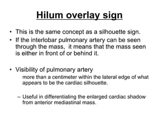 Hilum overlay sign
• This is the same concept as a silhouette sign.
• If the interlobar pulmonary artery can be seen
through the mass, it means that the mass seen
is either in front of or behind it.
• Visibility of pulmonary artery
more than a centimeter within the lateral edge of what
appears to be the cardiac silhouette.
– Useful in differentiating the enlarged cardiac shadow
from anterior mediastinal mass.
 