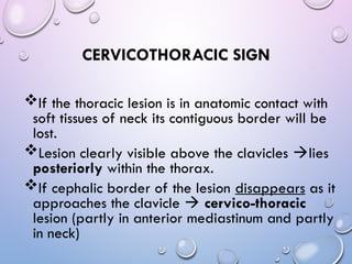 Stuart Sign Cervical Abnormal signs on a Chest X-Ray (Plain Radiograph) | PPT