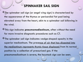 Abnormal signs on a Chest X-Ray (Plain Radiograph) | PPT