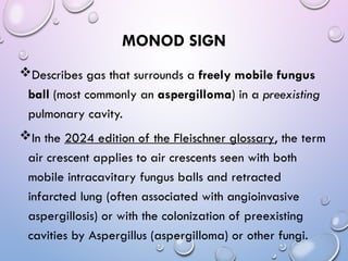 Manod Sign Abnormal signs on a Chest X-Ray (Plain Radiograph) | PPT