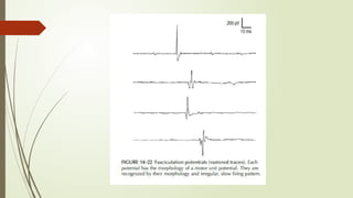 ABNORMAL AND NORMAL SPONTANEOUS ACTIVITY | PPTX
