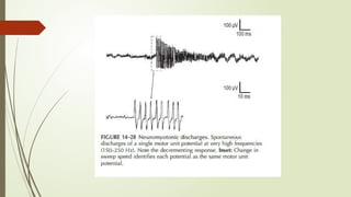ABNORMAL AND NORMAL SPONTANEOUS ACTIVITY | PPTX