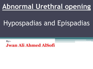 Abnormal Urethral opening
Hypospadias and Epispadias
By:-
Jwan Ali Ahmed AlSofi
 