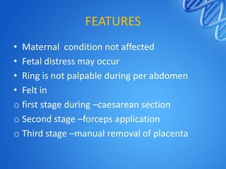 FEATURES
• Maternal condition not affected
• Fetal distress may occur
• Ring is not palpable during per abdomen
• Felt in
o first stage during –caesarean section
o Second stage –forceps application
o Third stage –manual removal of placenta
 