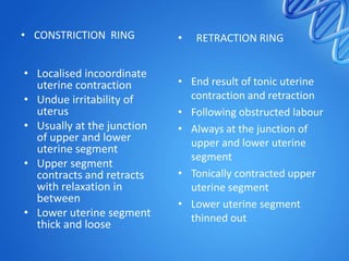 • Localised incoordinate
uterine contraction
• Undue irritability of
uterus
• Usually at the junction
of upper and lower
uterine segment
• Upper segment
contracts and retracts
with relaxation in
between
• Lower uterine segment
thick and loose
• End result of tonic uterine
contraction and retraction
• Following obstructed labour
• Always at the junction of
upper and lower uterine
segment
• Tonically contracted upper
uterine segment
• Lower uterine segment
thinned out
• CONSTRICTION RING • RETRACTION RING
 