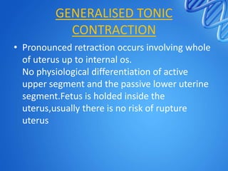 GENERALISED TONIC
CONTRACTION
• Pronounced retraction occurs involving whole
of uterus up to internal os.
No physiological differentiation of active
upper segment and the passive lower uterine
segment.Fetus is holded inside the
uterus,usually there is no risk of rupture
uterus
 