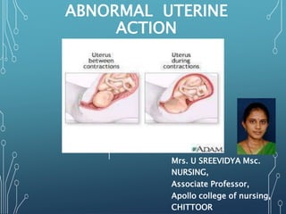 ABNORMAL UTERINE
ACTION
Mrs. U SREEVIDYA Msc.
NURSING,
Associate Professor,
Apollo college of nursing,
CHITTOOR
 