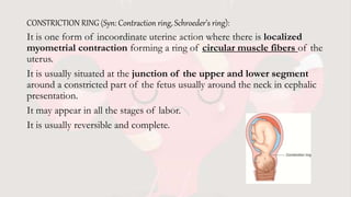 CONSTRICTION RING (Syn: Contraction ring, Schroeder’s ring):
It is one form of incoordinate uterine action where there is localized
myometrial contraction forming a ring of circular muscle fibers of the
uterus.
It is usually situated at the junction of the upper and lower segment
around a constricted part of the fetus usually around the neck in cephalic
presentation.
It may appear in all the stages of labor.
It is usually reversible and complete.
 