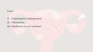 Causes:
(i) Cephalopelvic disproportion
(ii) Obstruction
(iii) Injudicious use of oxytocics
 