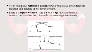 • But in multiparae, retraction continues with progressive circumferential
dilatation and thinning of the lower segment.
• There is progressive rise of the Bandl’s ring, moving nearer and
nearer to the umbilicus and ultimately, the lower segment ruptures.
 