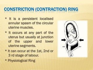 ABNORMAL UTERINE ACTION WITH NURSING MANAGEMENT | PDF