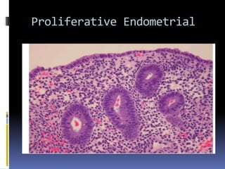 Proliferative Endometrial
 