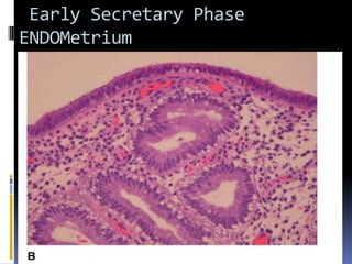 Early Secretary Phase
ENDOMetrium
 