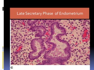 Late Secretary Phase of Endometrium
 