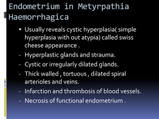 Endometrium in Metyrpathia
Haemorrhagica
 Usually reveals cystic hyperplasia( simple
hyperplasia with out atypia) called swiss
cheese appearance .
- Hyperplastic glands and strauma.
- Cystic or irregularly dilated glands.
- Thick walled , tortuous , dilated spiral
arterioles and veins.
- Infarction and thrombosis of blood vessels.
- Necrosis of functional endometrium .
 